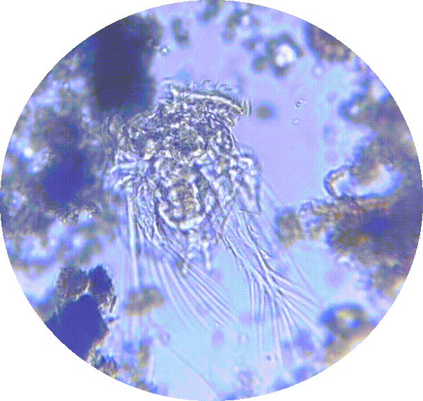 My amateur microscopy